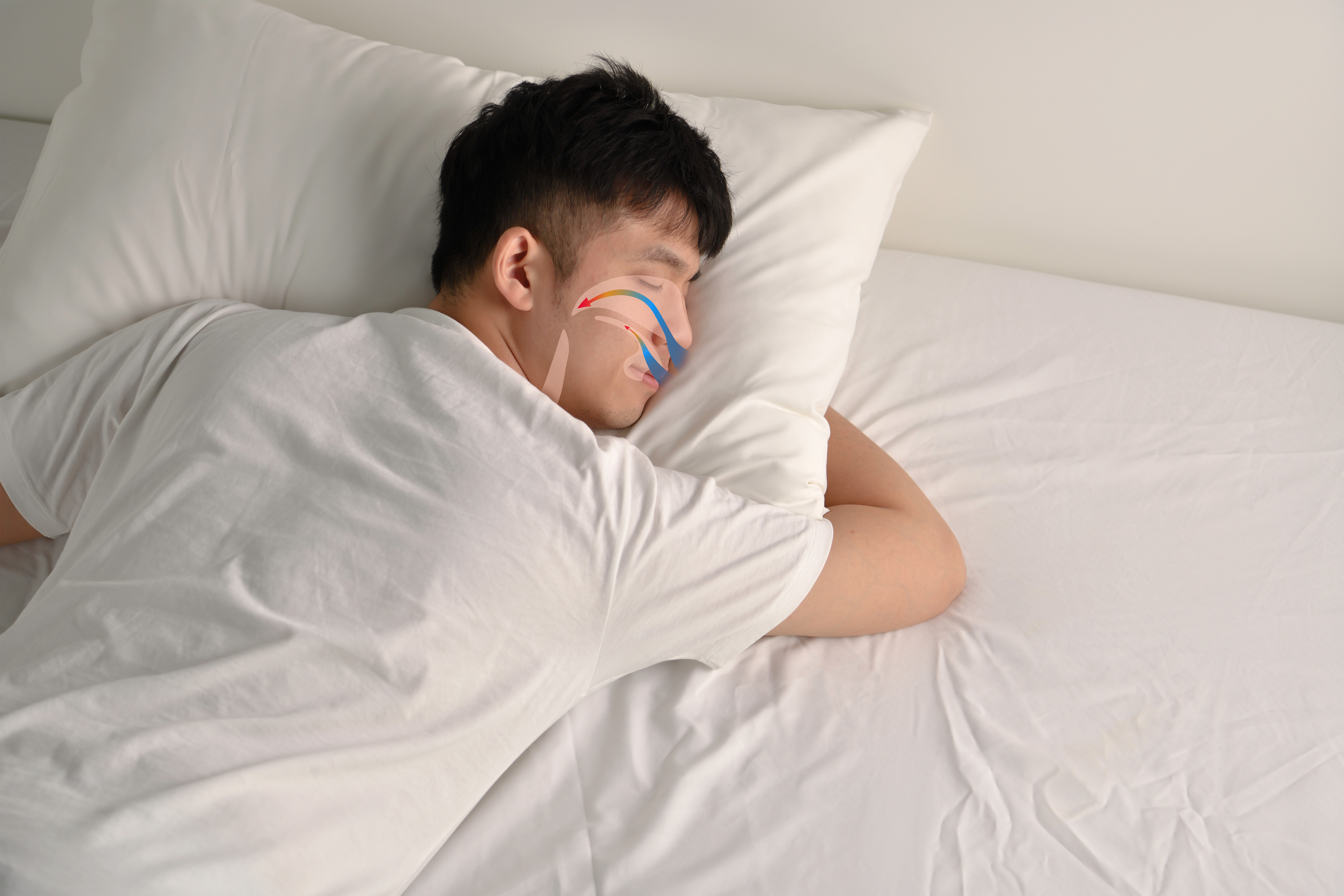 Snore Laser