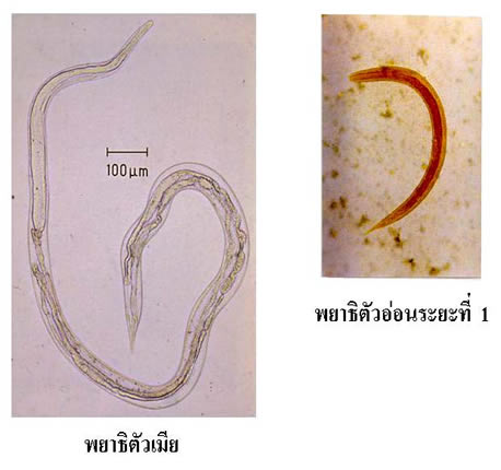 พยาธิเส้นด้าย