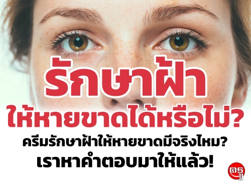 รักษาฝ้าให้หายขาดได้หรือไม่? ครีมรักษาฝ้าให้หายขาดมีจริงไหม? เราหาคำตอบมาให้แล้ว!