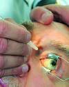 ปัญหาเรื่องตา ในผู้ป่วยเบาหวาน