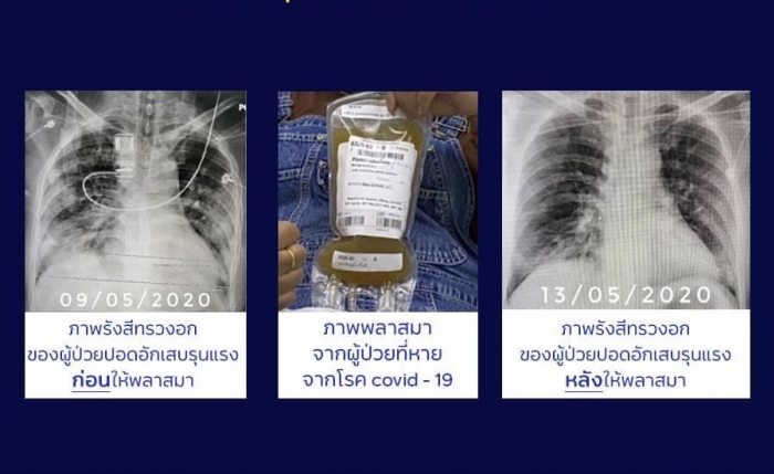 คำบรรยายภาพ